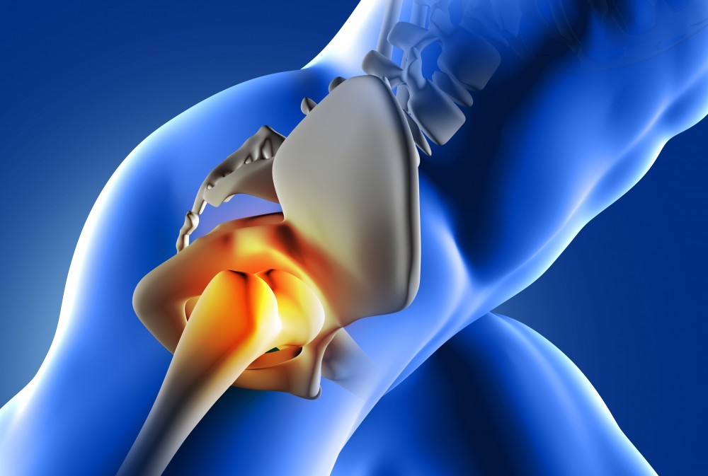 Total Hip Replacement